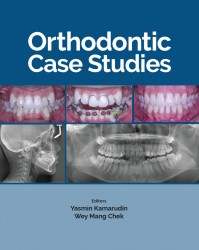 Orthodontic Case Studies